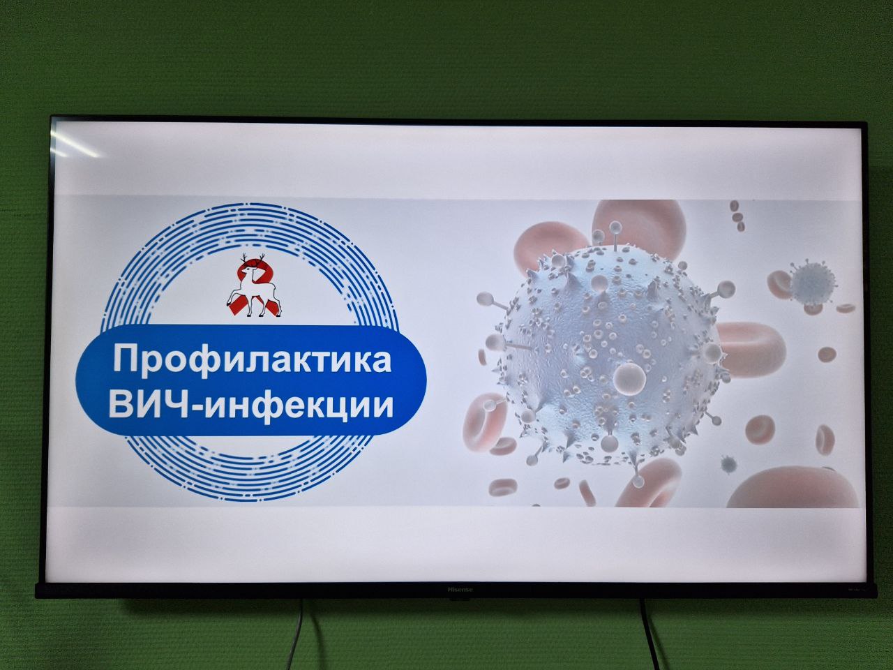 Профилактика ВИЧ-инфекции